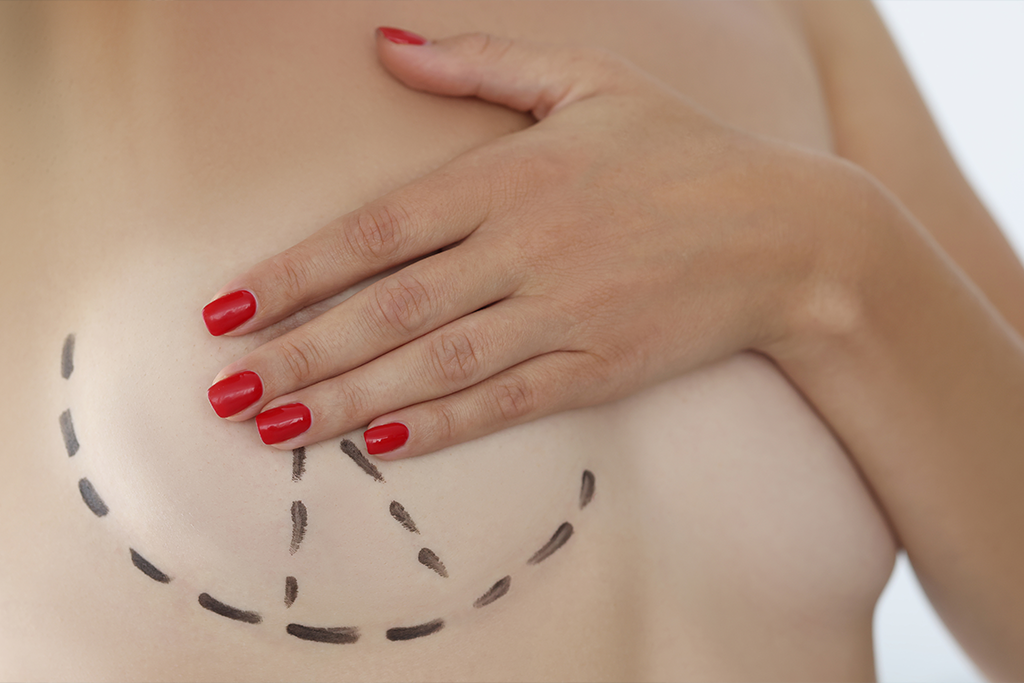 Breast Surgery