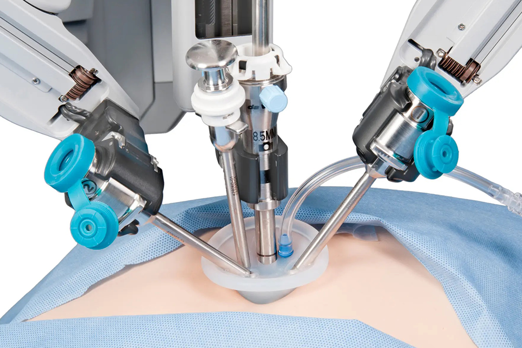 Robotic Surgery