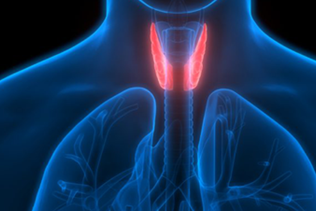 Thyroid cancer